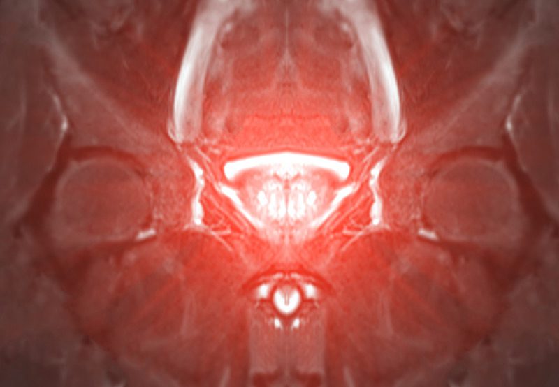 3D-medical-imaging-showing-MRI-and-ultrasound-fusion
