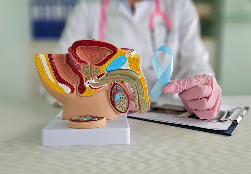 Doctor-explaining-prostate-cancer-treatment-with-anatomical-model