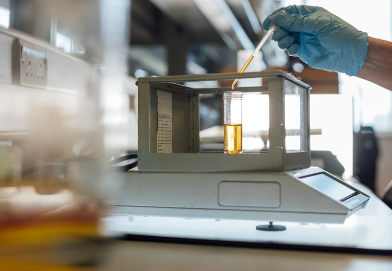 Lab-testing-for-a-UTI Lab-testing-for-a-UTI