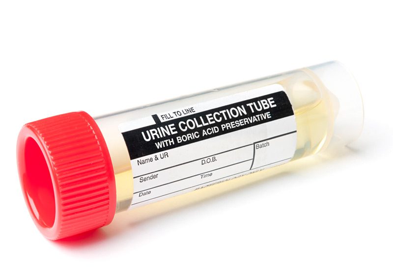 Labeled-urine-collection-tube