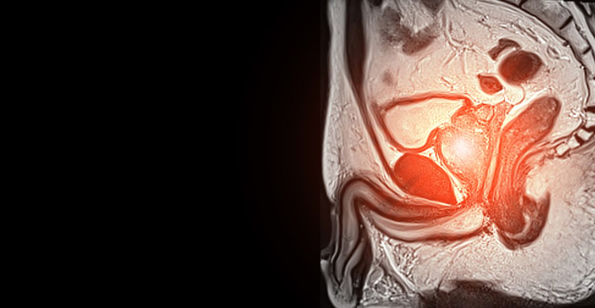 MRI-image-of-prostate-gland-for-diagnostic-evaluation