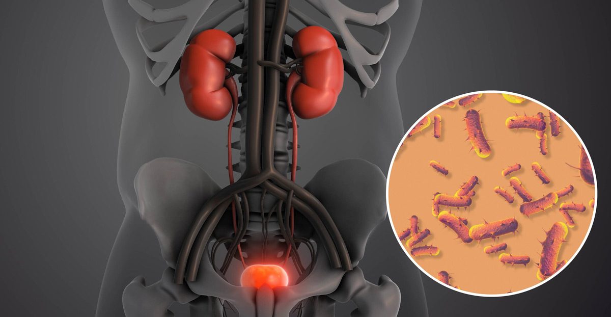 Medical-illustration-of-an-infection Medical-illustration-of-an-infection