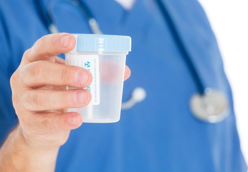 Nurse-holding-urine-sample-cup