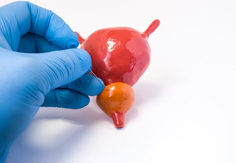 Urologist-showing-prostate-biopsy-procedure