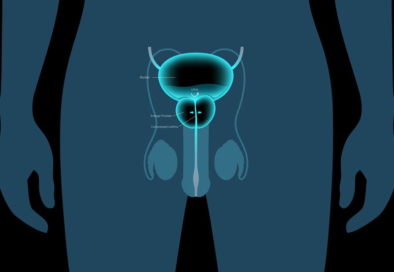 View-of-the-bladder,-prostate,-and-urethra